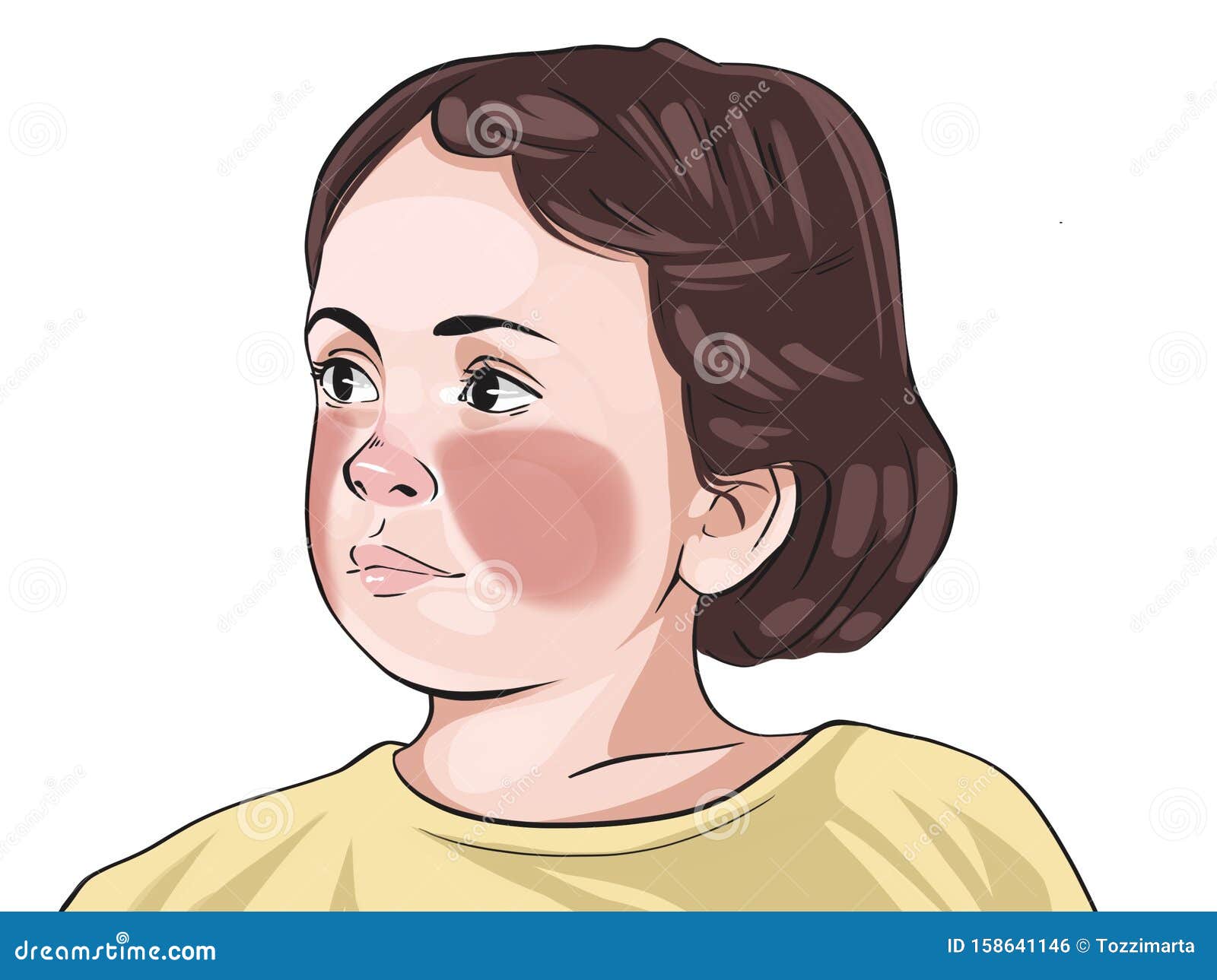 644 Scarlet Fever Images, Stock Photos, 3D objects, & Vectors