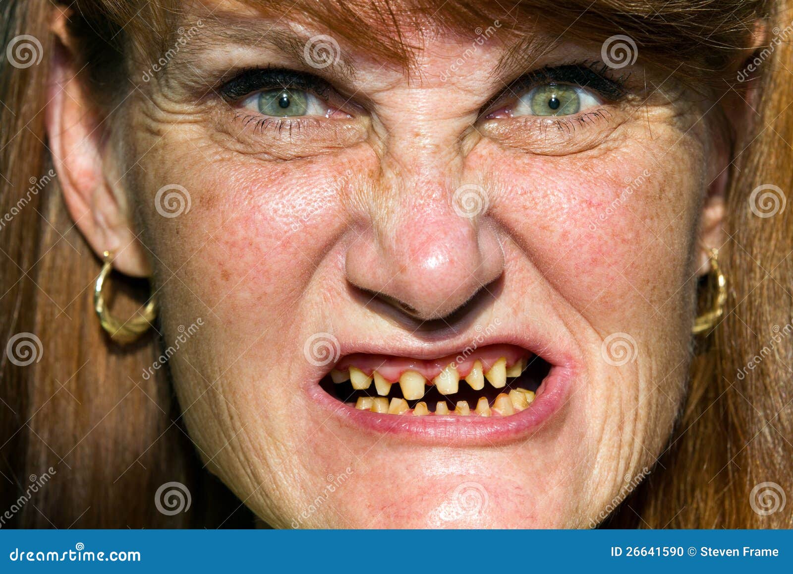 scary-face-bad-teeth-26641590.jpg