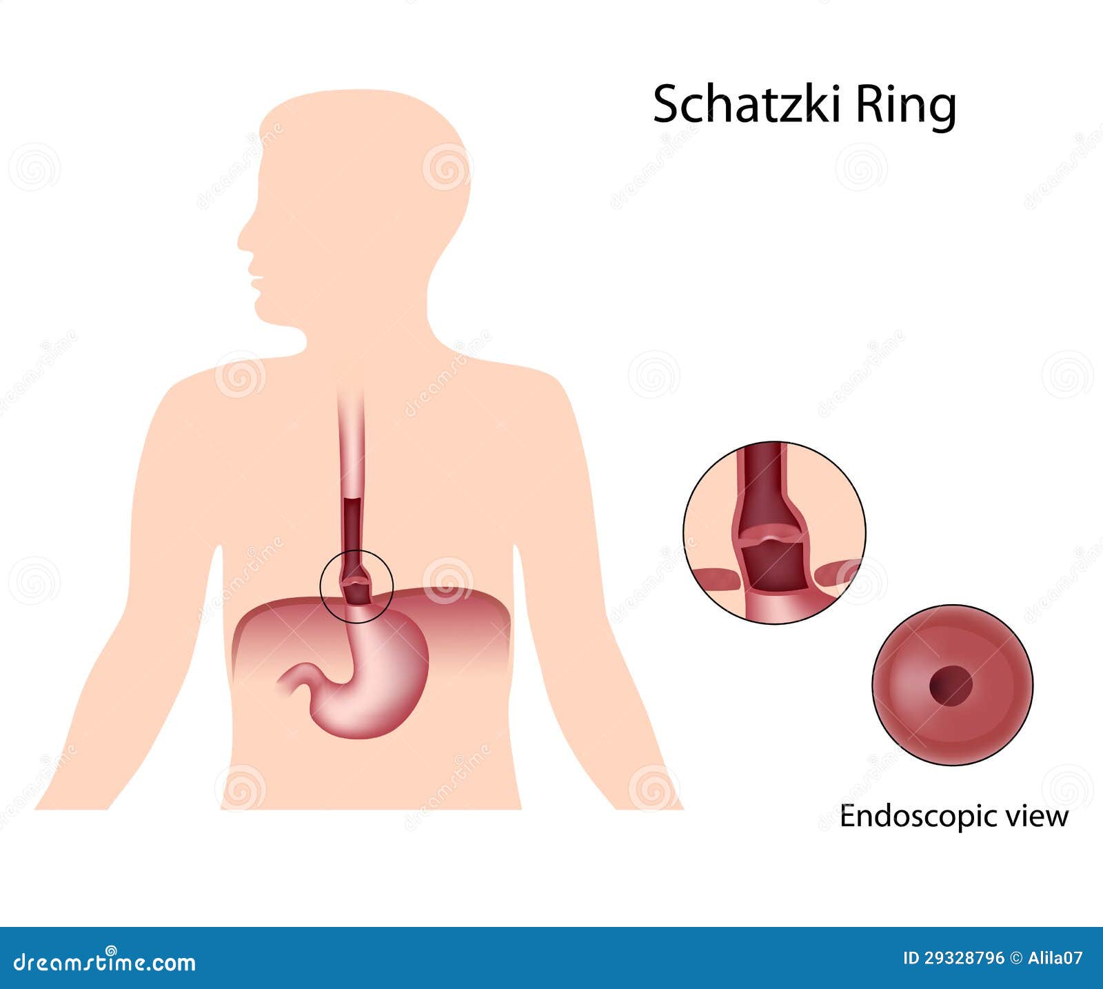 Imaging of esophagus - YouTube