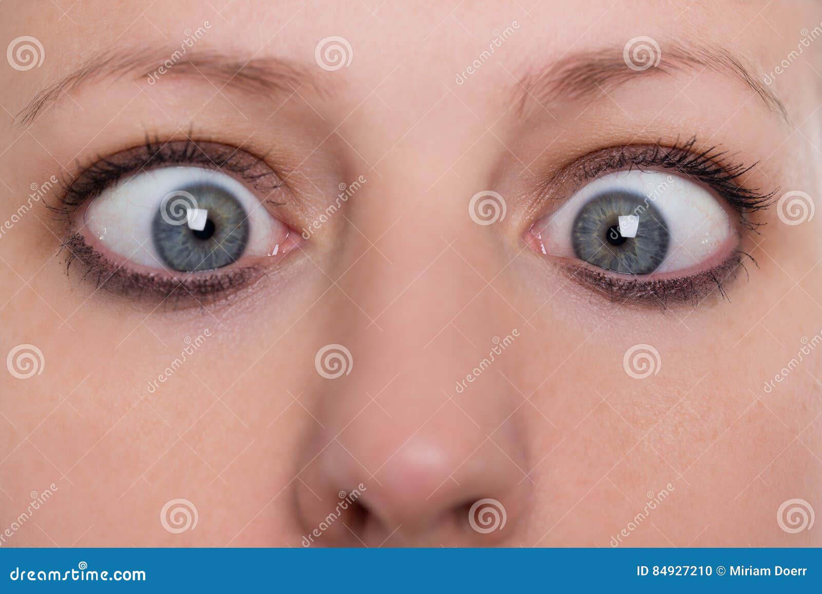 Schliessen Sie Oben Frau Schielt Konzeptschielen Und Schielende Augen Stockfoto Bild Von Augen Schielt