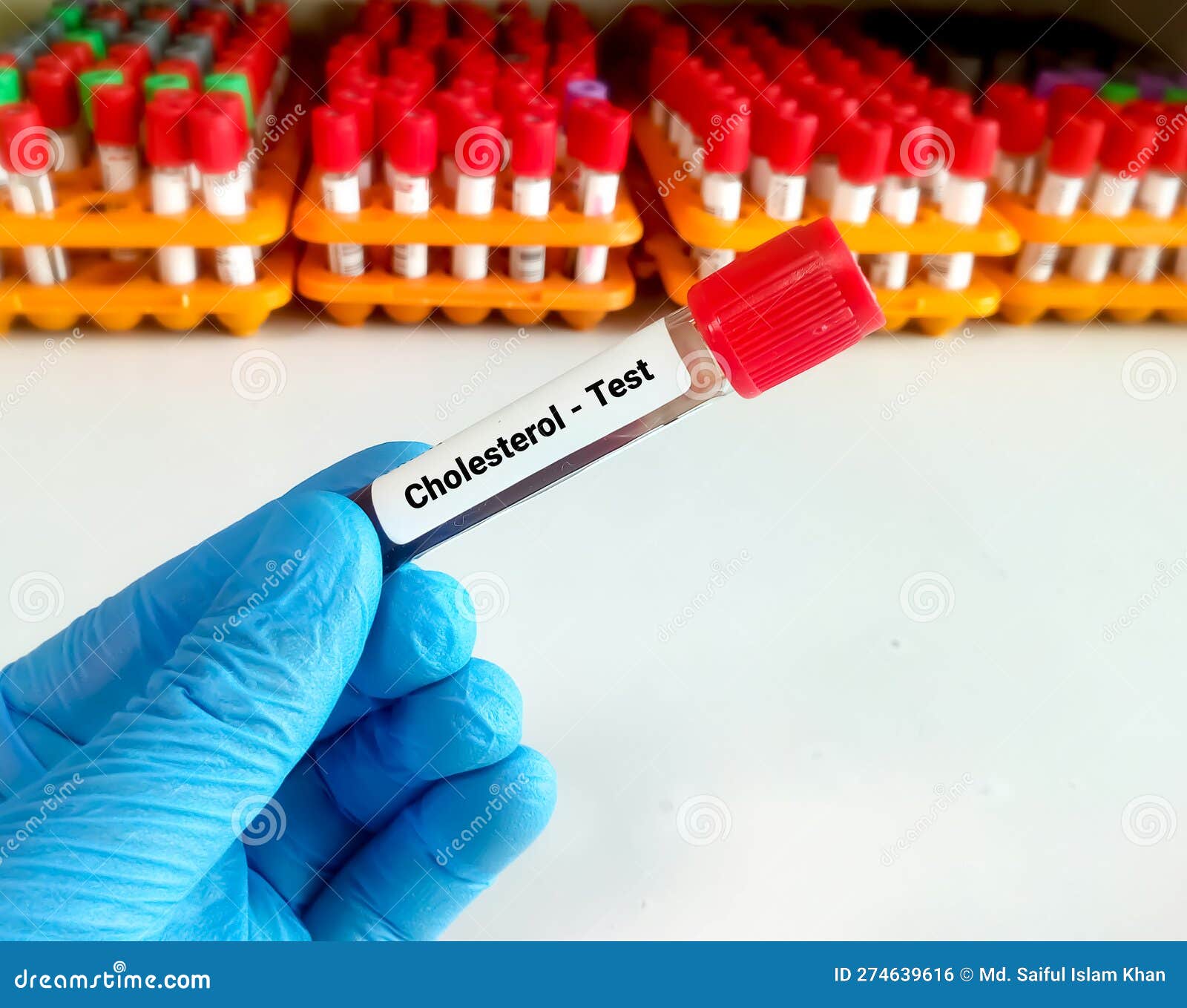 Blood Sample for Cholesterol Test Stock Photo Image of cardiac