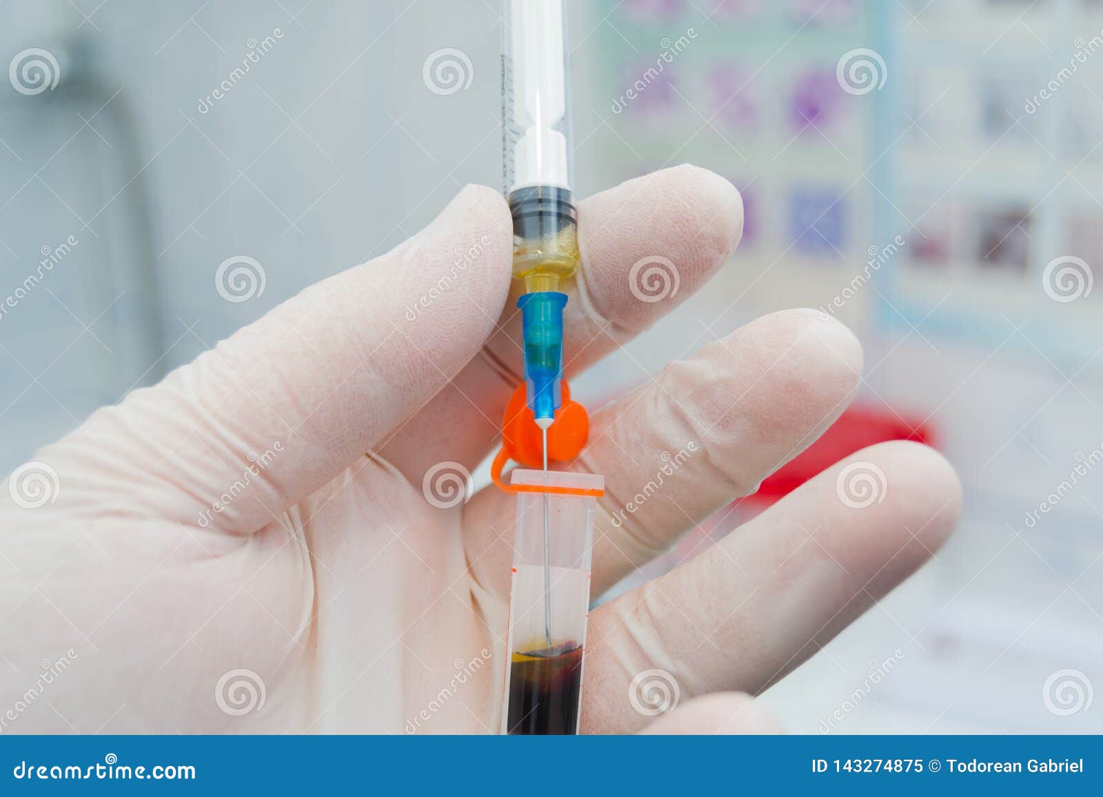 Scientist Holding in His Hand a Centrifuged Blood Sample with Hemolysis