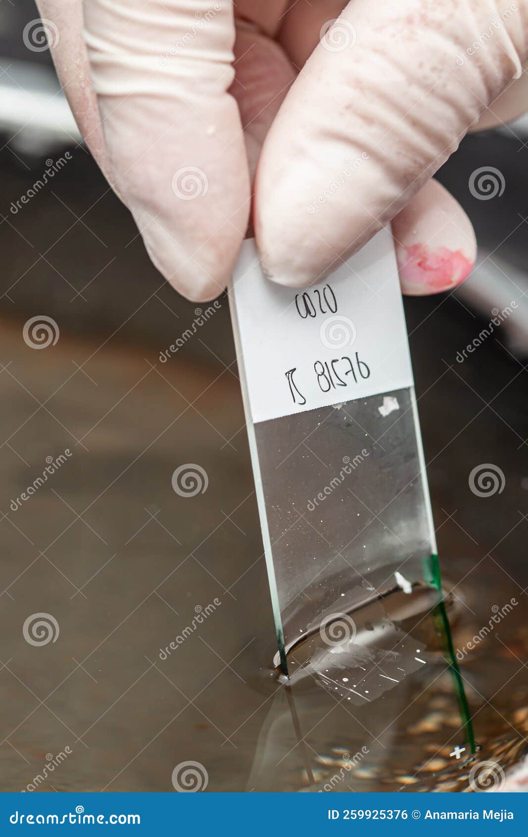 Scientist Preparing a Paraffin Embedded Tissue for Pathology Analysis