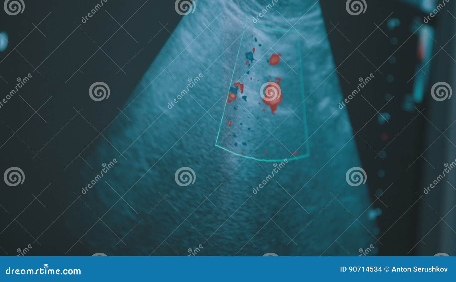 Screen of Echo-cardiography Ultrasound Machine. Stock Footage - Video
