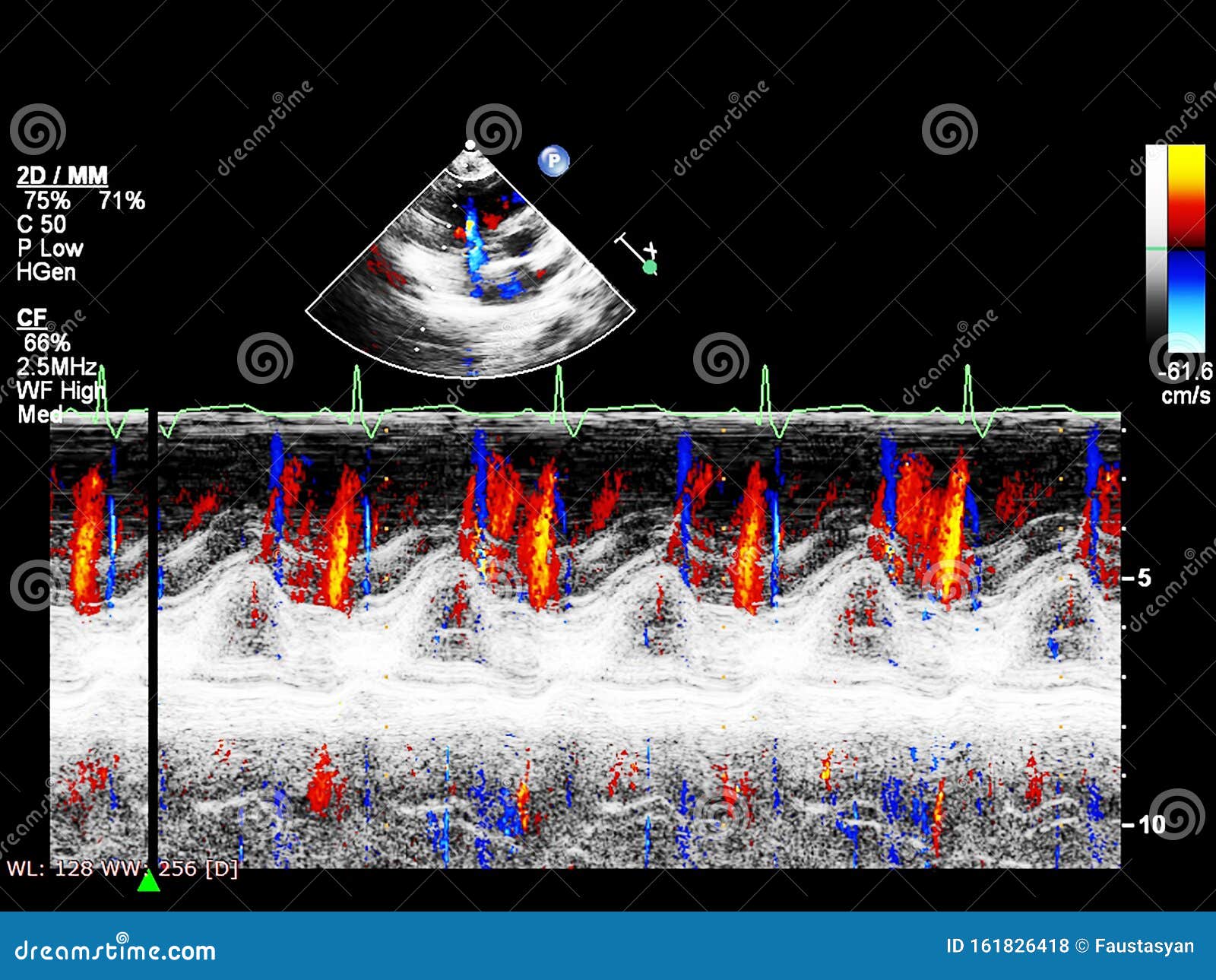 Screen of Echocardiography Ultrasound Machine Stock Photo - Image of