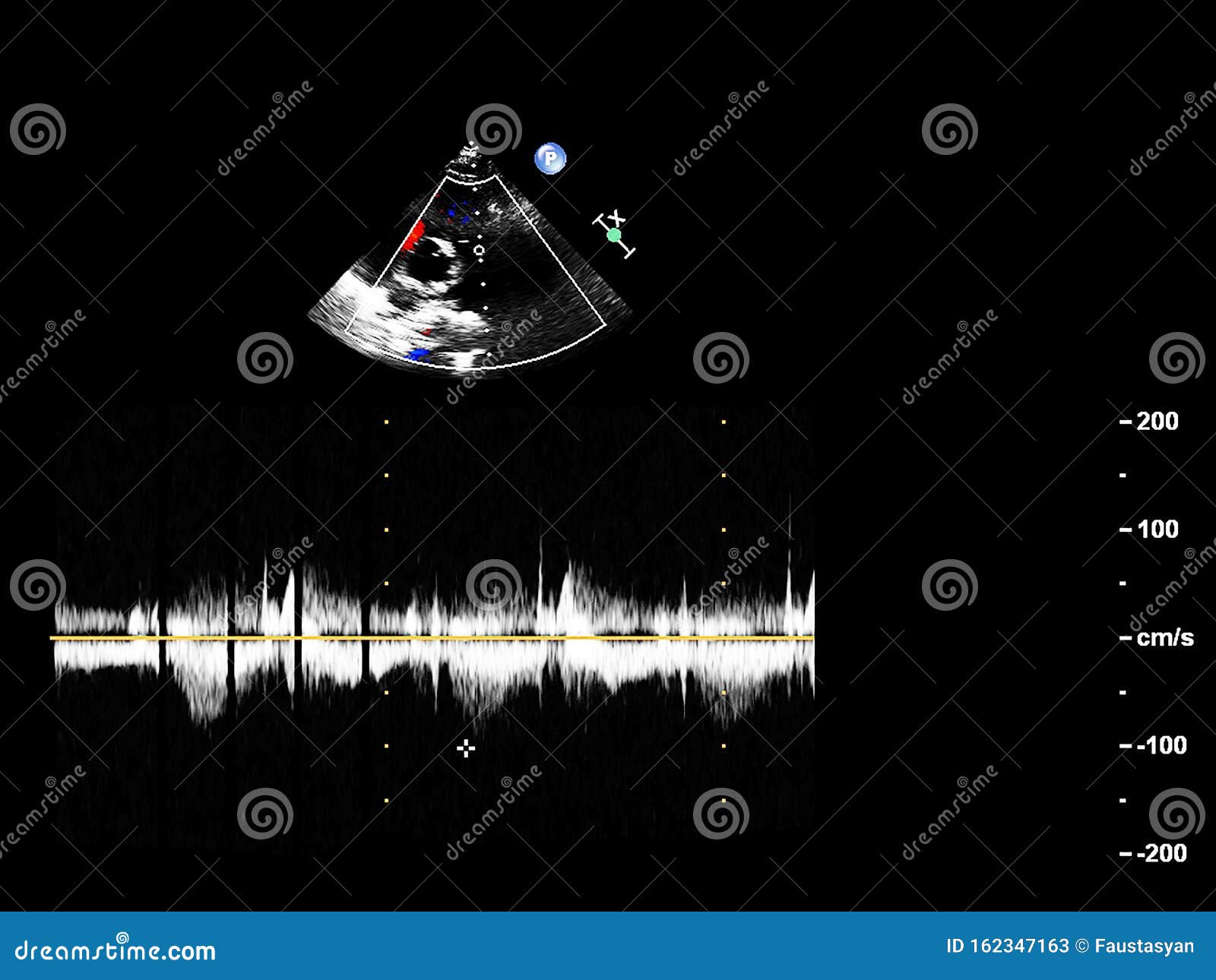 Screen of Echocardiography Ultrasound Machine Stock Image - Image of