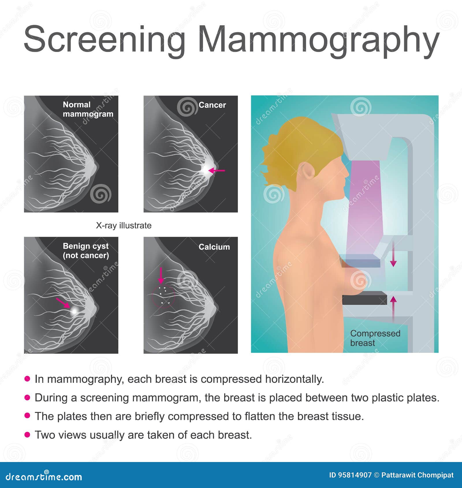 breast screening mammography Grandpa shooting sperm