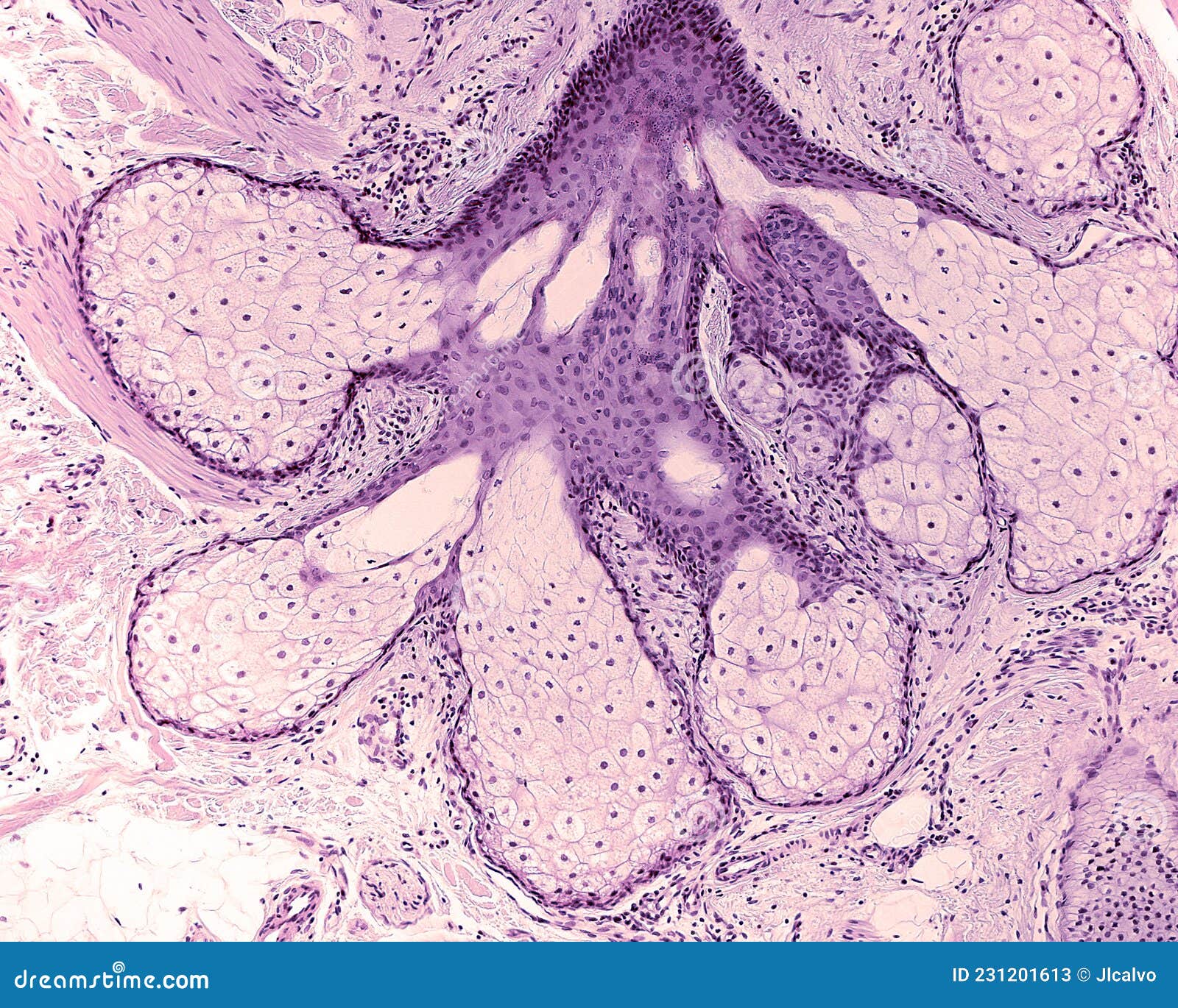 pilosebaceous unit. sebaceous gland