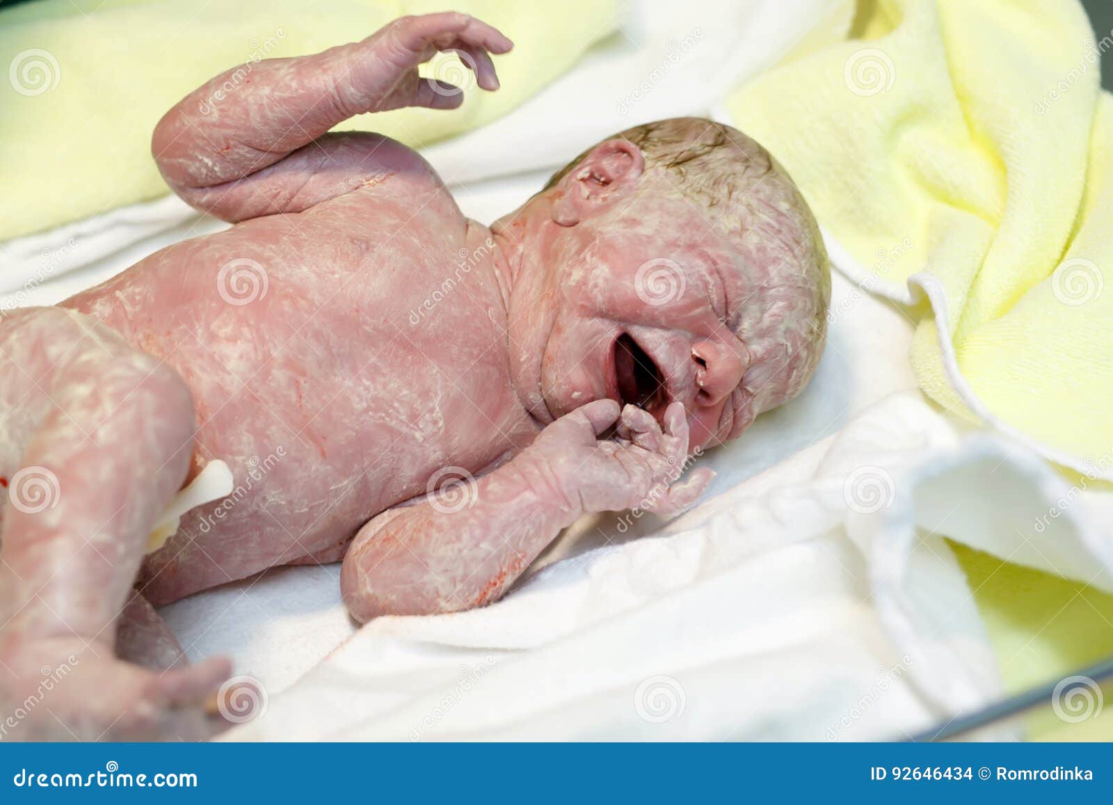 Secondes Et Minutes Nouveau Nees D Enfant De Bebe Apres La Naissance Se Trouvant Sur La Serviette Photo Stock Image Du Medecine Livrer