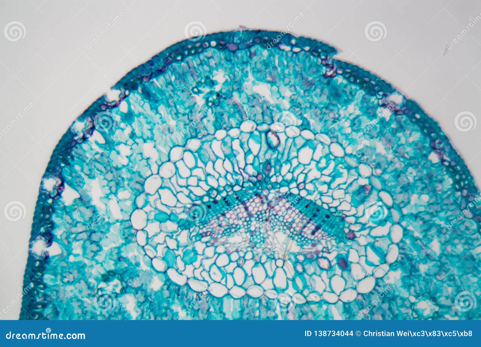 Conifer Needle with Environmental Damages Under a Microscope Stock