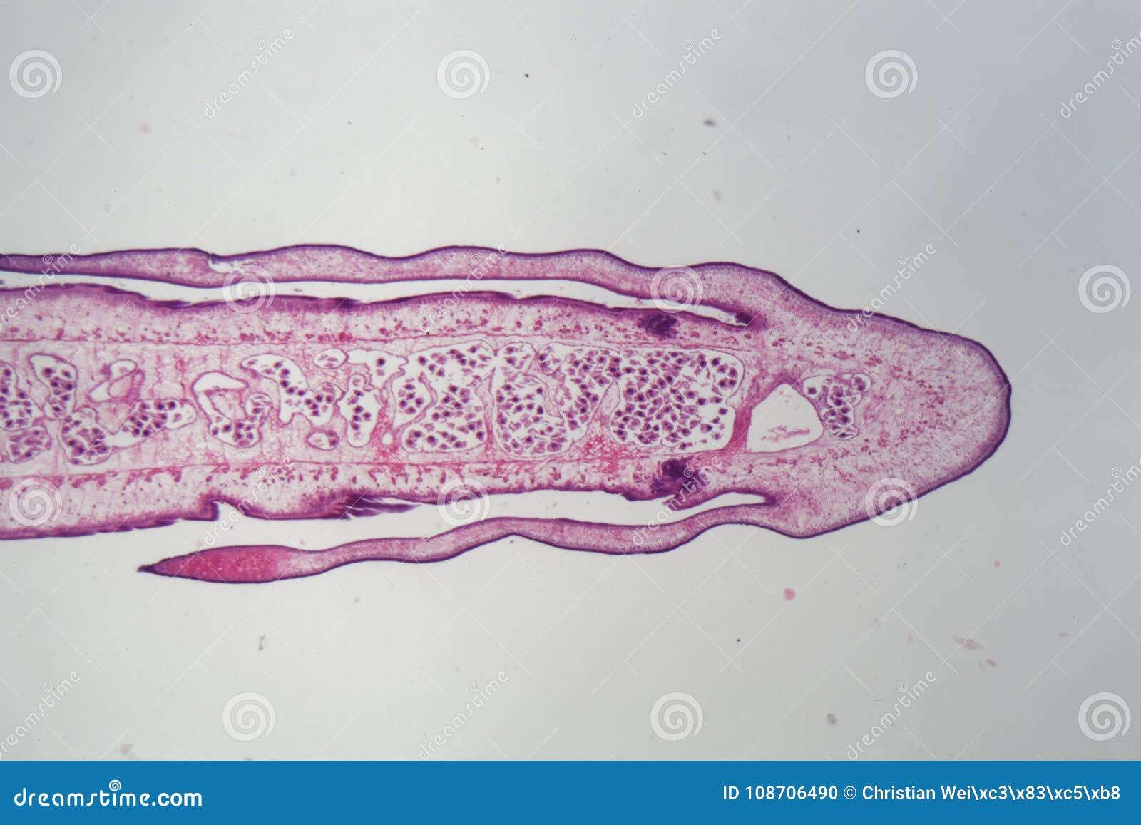 segment of a tapeworm body proglottid