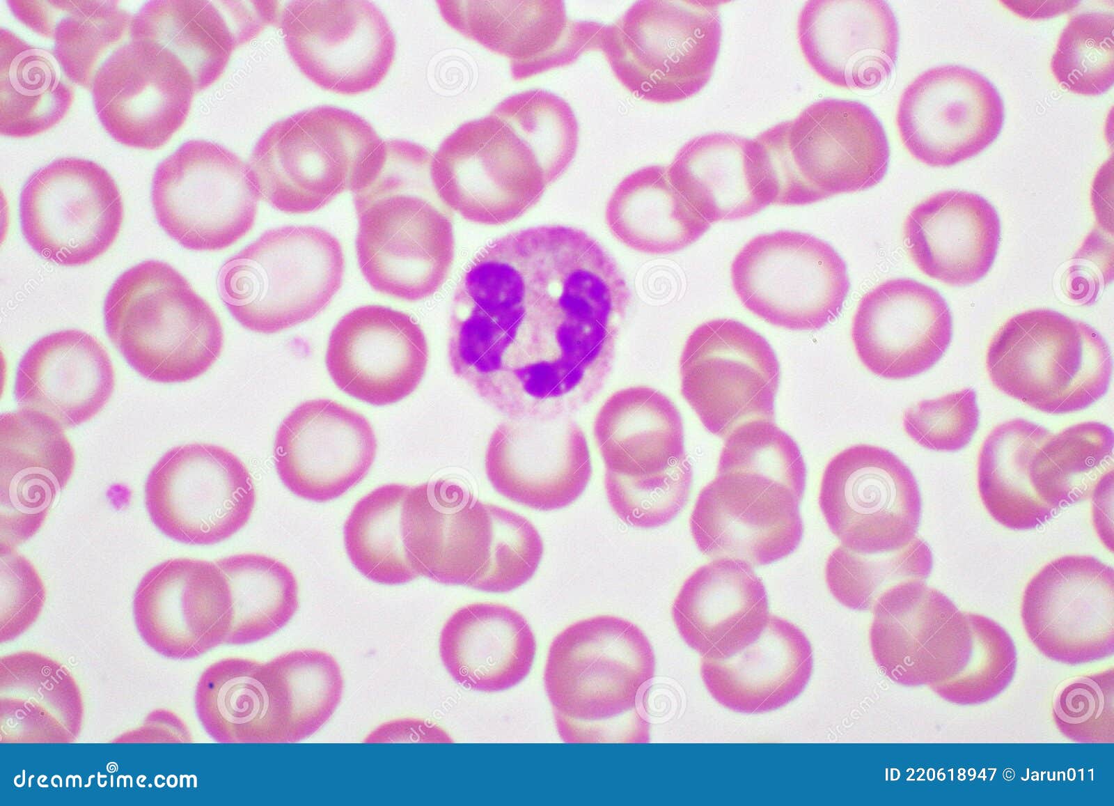 Segmented Neutrophil Cell in Human Blood Smear Stock Image Image of