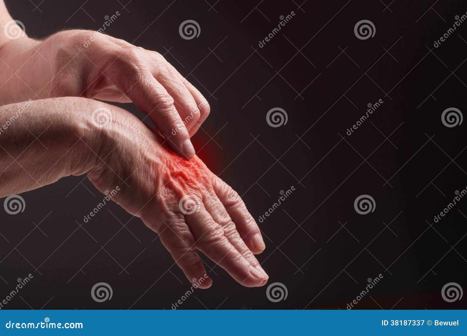 senior hands. suffering from pain and rheumatism