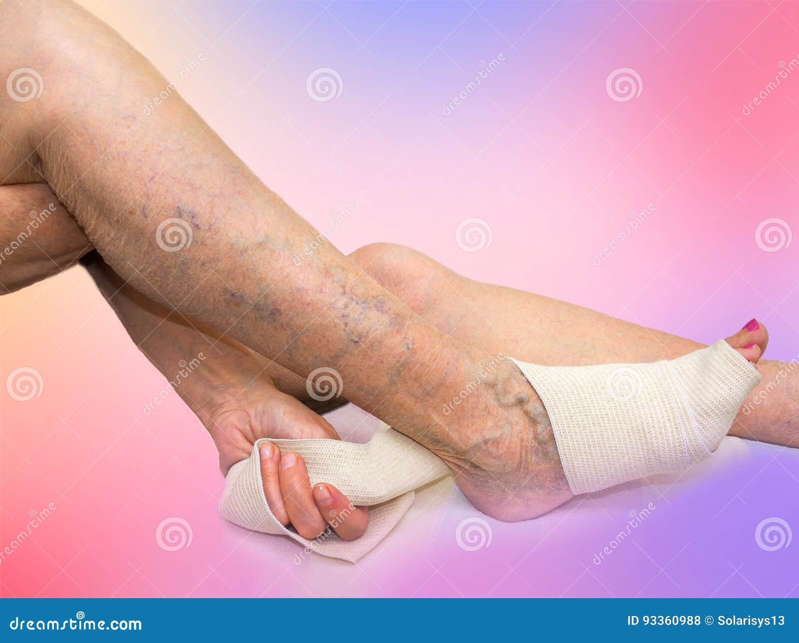 Elastic vene varicoase bandaj ca bandajarea un picior cu un bandaj elastic cu varice
