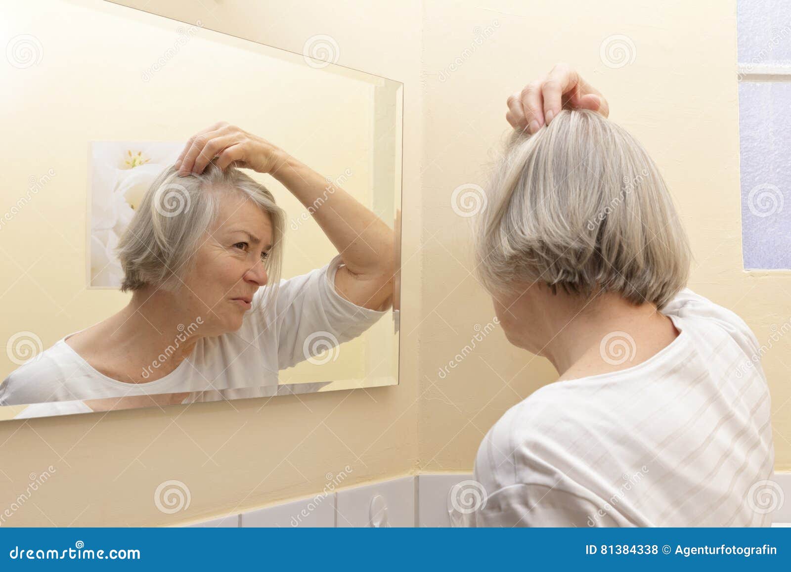 Best Causes Of Hair Loss In Elderly Females for Oval Face