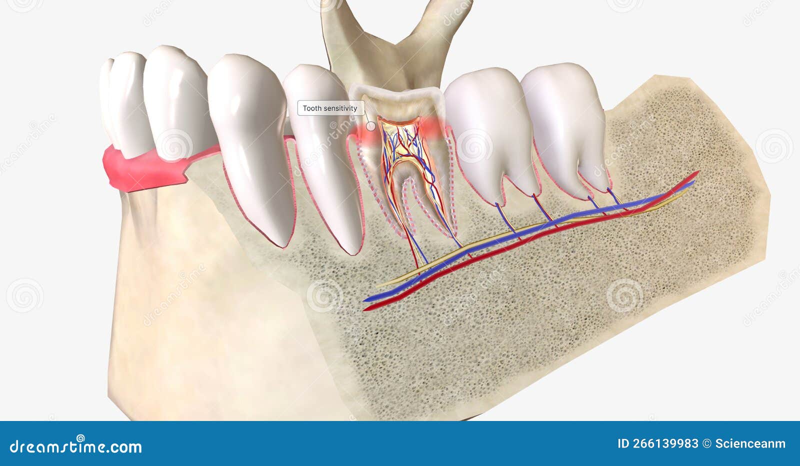 Sensitive Teeth is a Common Dental Condition Characterized by Sharp