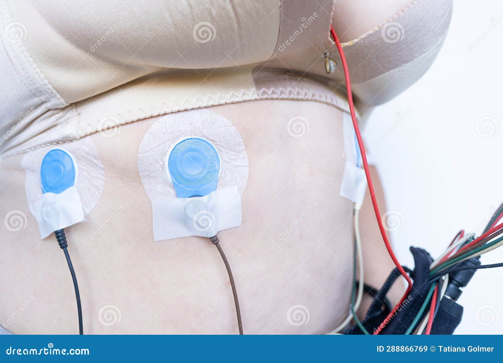 https://thumbs.dreamstime.com/z/sensors-body-holter-monitoring-woman-holter-monitor-monitoring-electrocardiogram-blood-pressure-cardiac-288866769.jpg