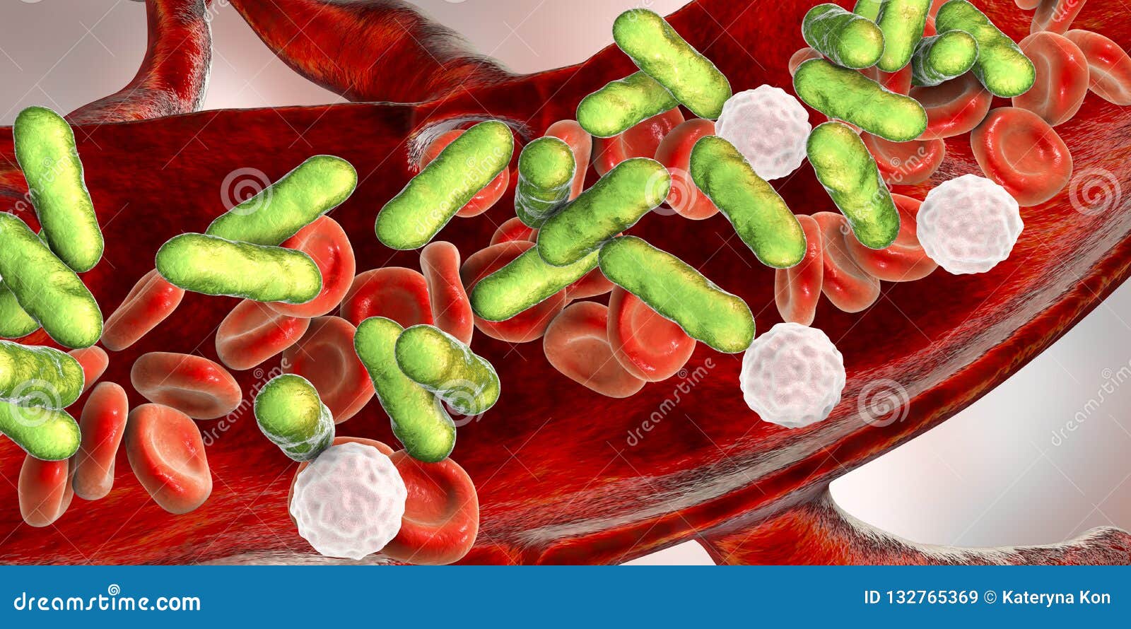 sepsis, bacteria in blood