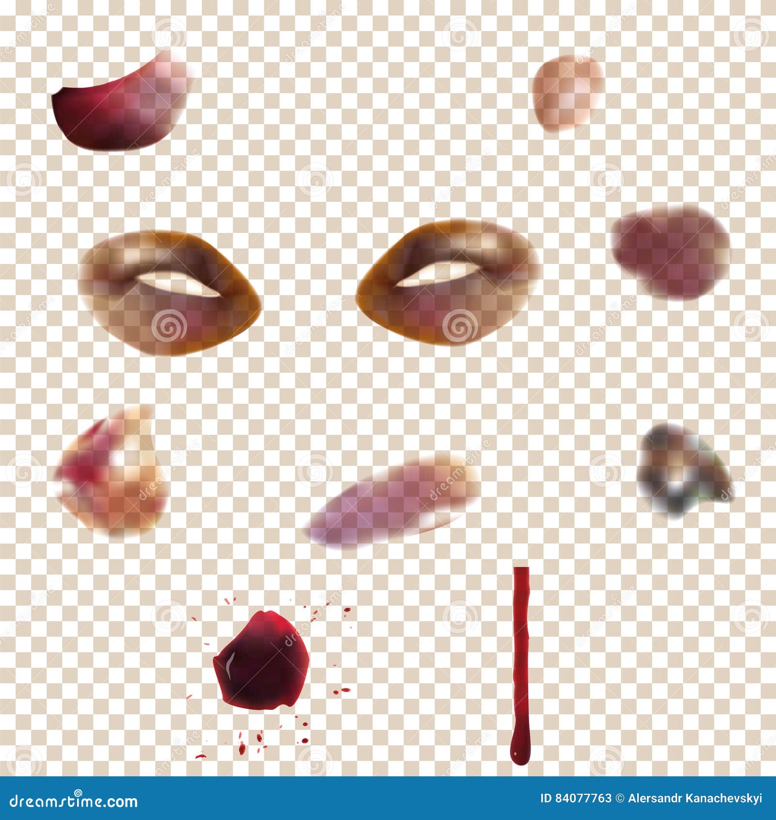 Bruising From Using A Needle To Draw Blood In The Arm RoyaltyFree