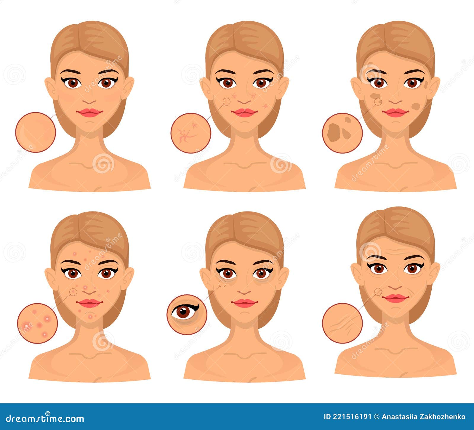 Seth Woman Different Types of Problem Skin, Enlarged Area for