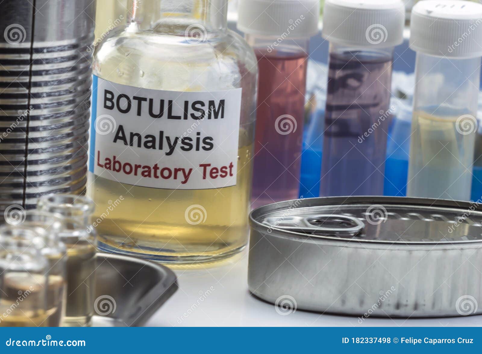 Several Samples of Tin Cans, Botulism Infection in Sick People Stock