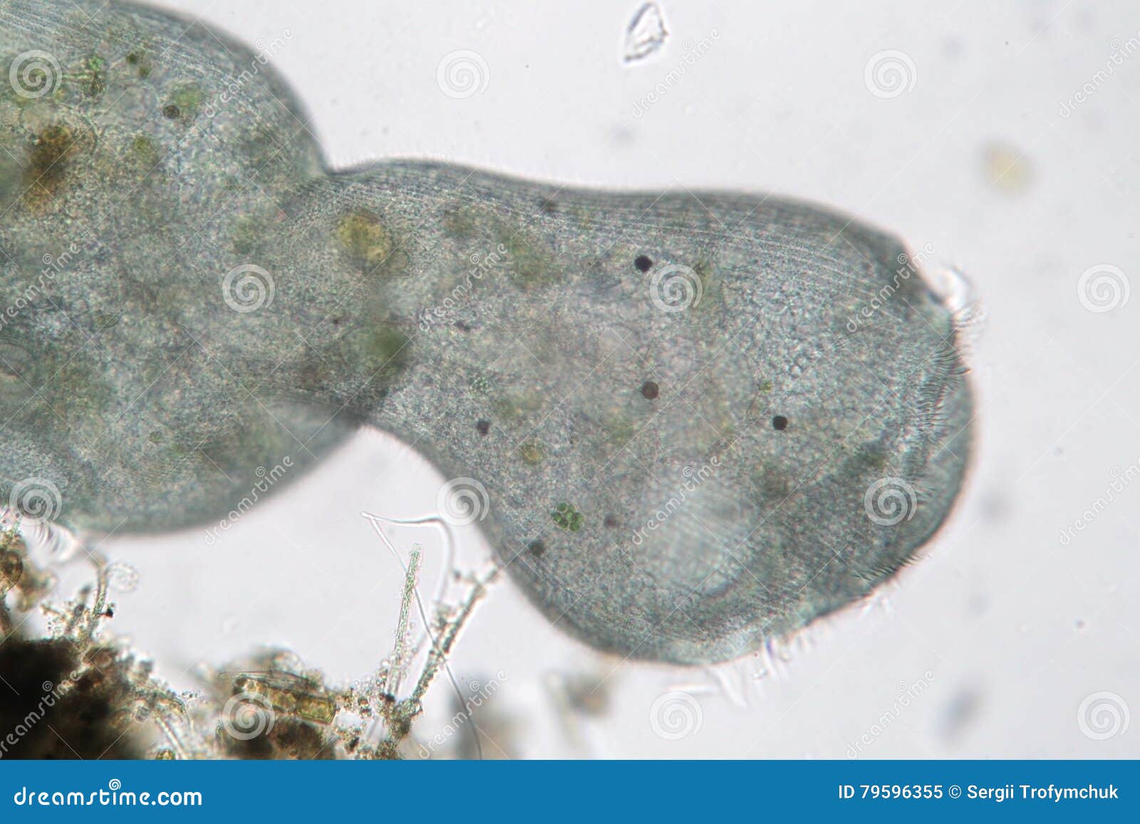  transformation of stentor or trumpet animalcules. filter-feeding microorganism, heterotrophic protozoan ciliate