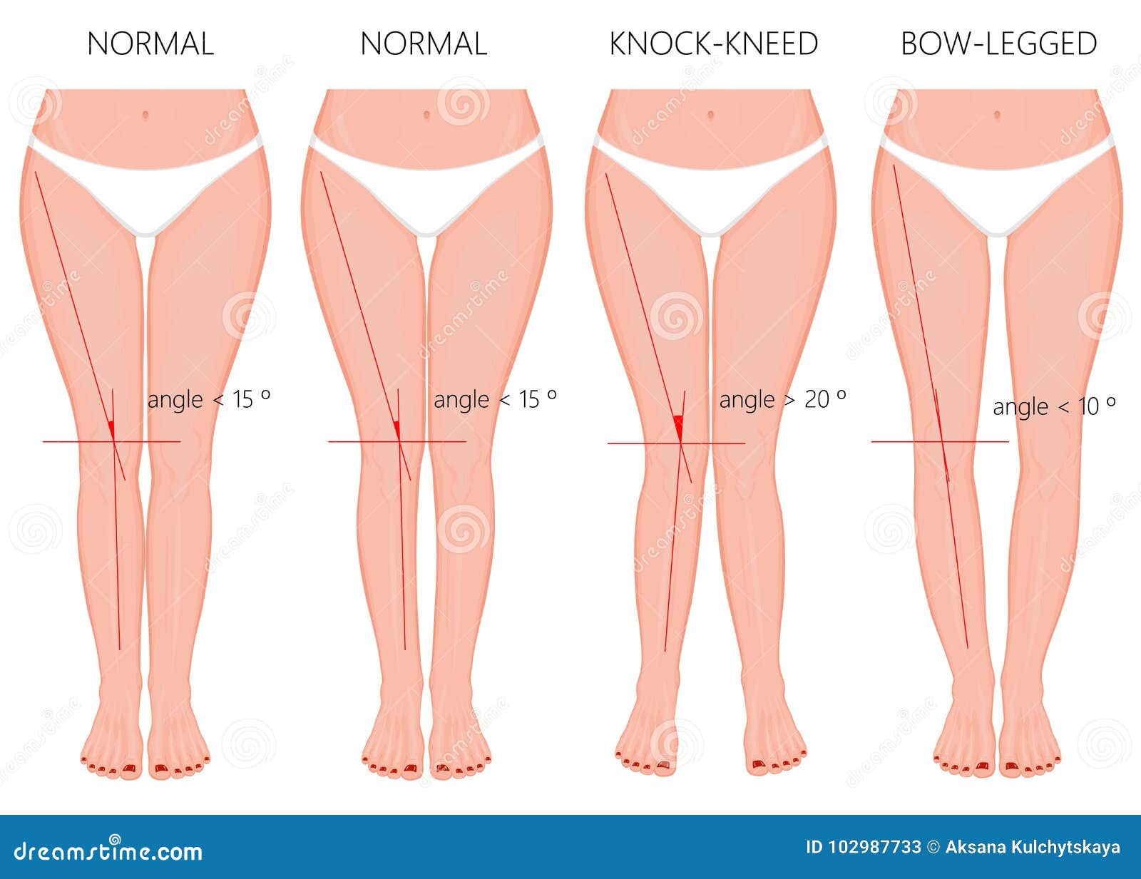 The Shape of Your Legs Can Tell You What You Are In a Relationship