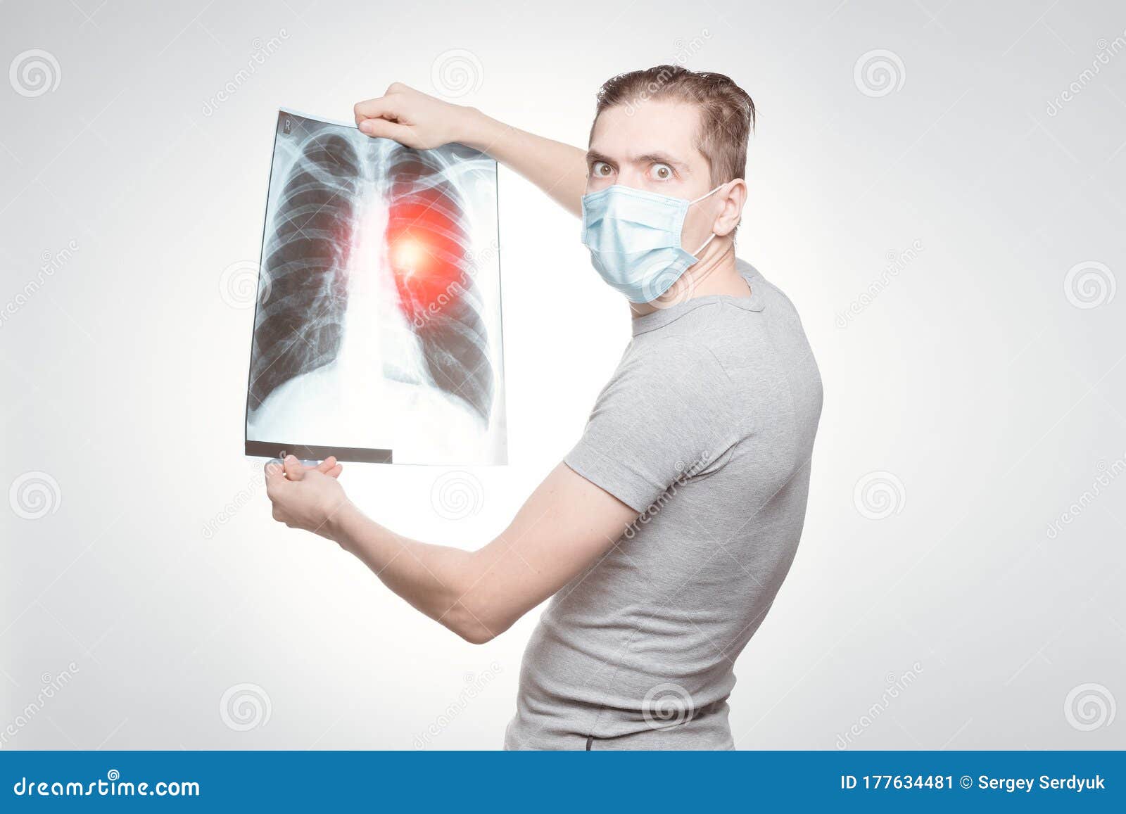 shocked man in mask holds his x-ray and analyze it, infected person. epidemia coronavirus. covid -19