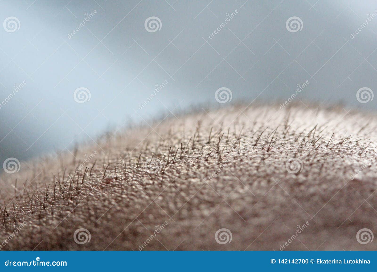 Short Hair on a Head Close Up. Scalp Man`s Head. Baldness. Bald Man Stock  Photo - Image of cranium, person: 142142700