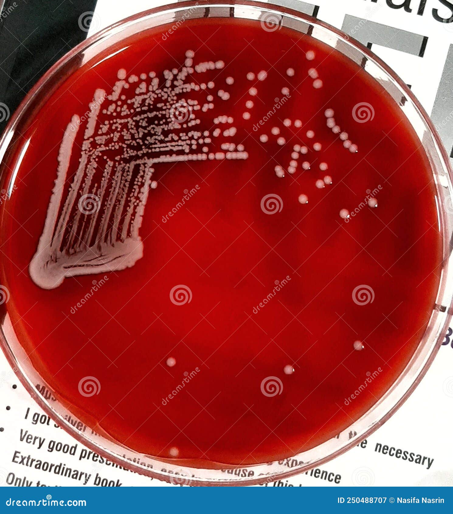 A Shot Of White Non Hemolytic Colonies Of E Coli Bacteria On Blood Agar