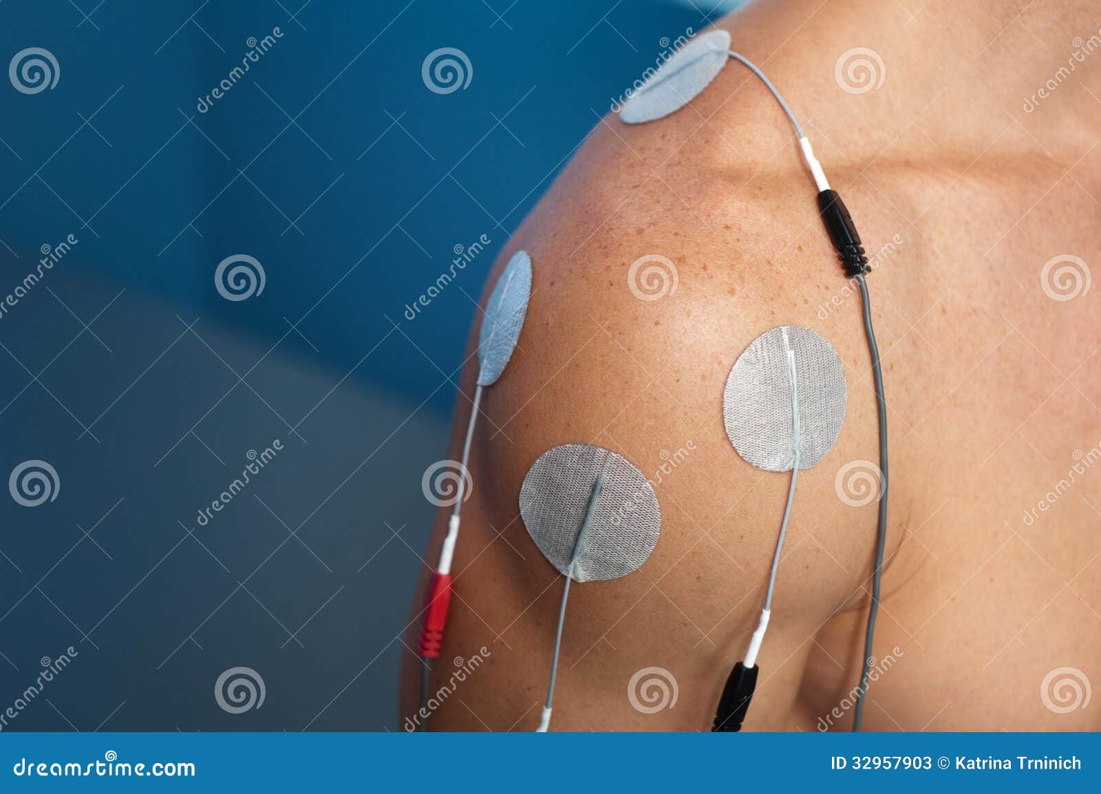 shoulder electrical stimulation / tens