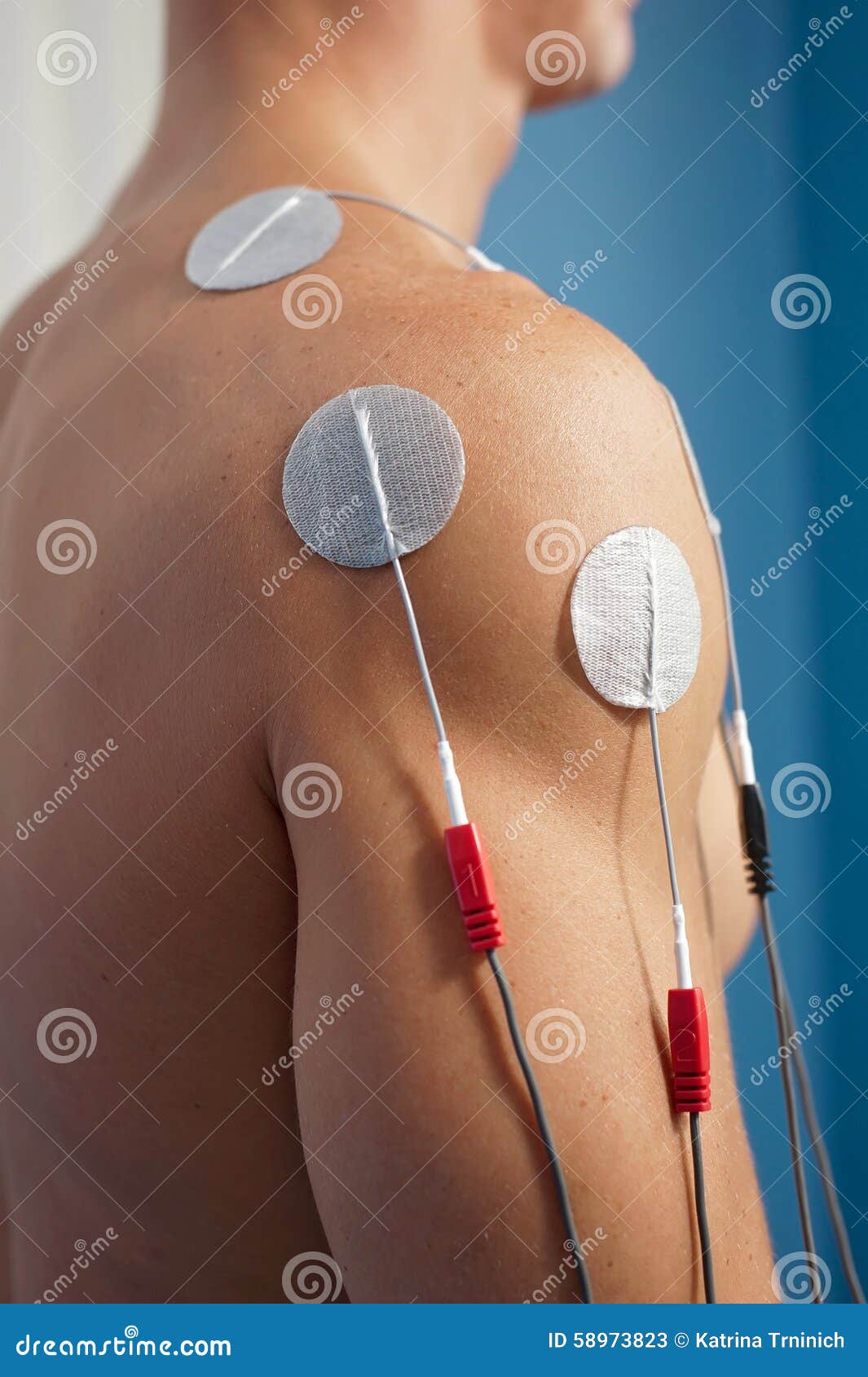 shoulder electrical stimulation / tens