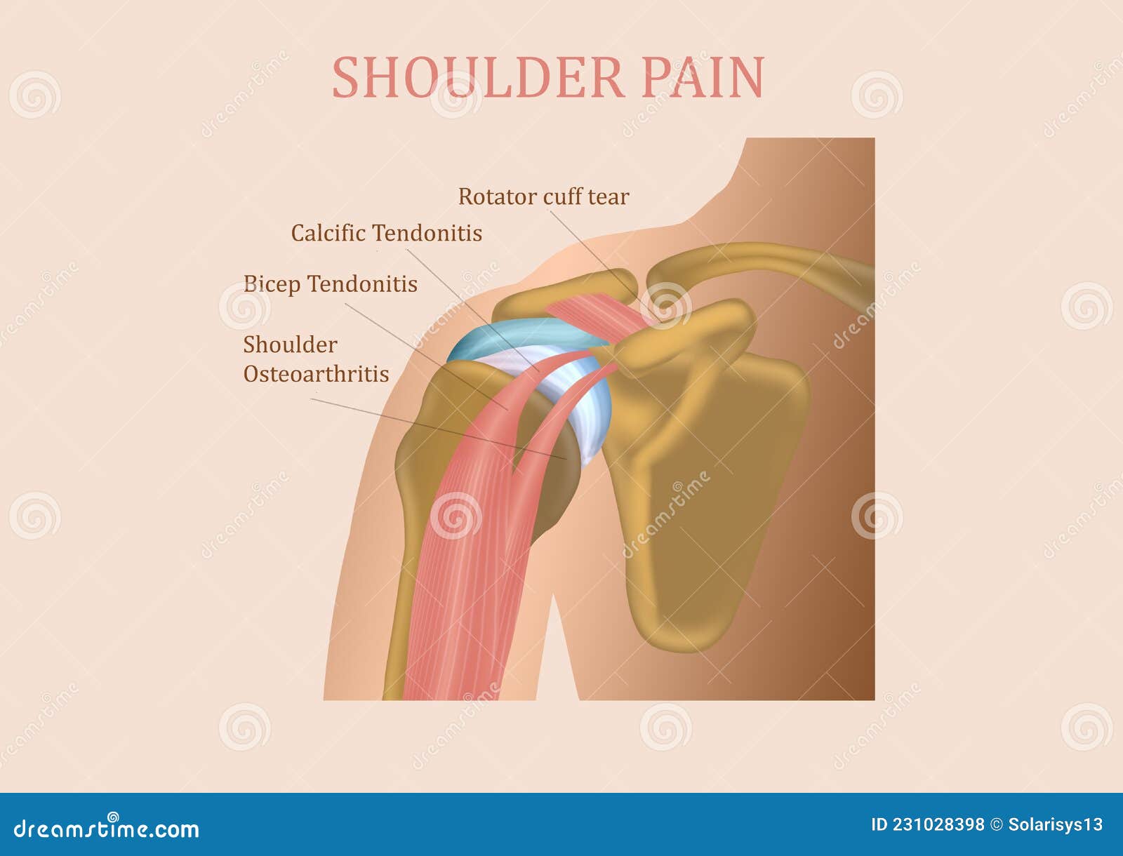 man with pain in shoulder. pain in the human body on a gray background with red dot