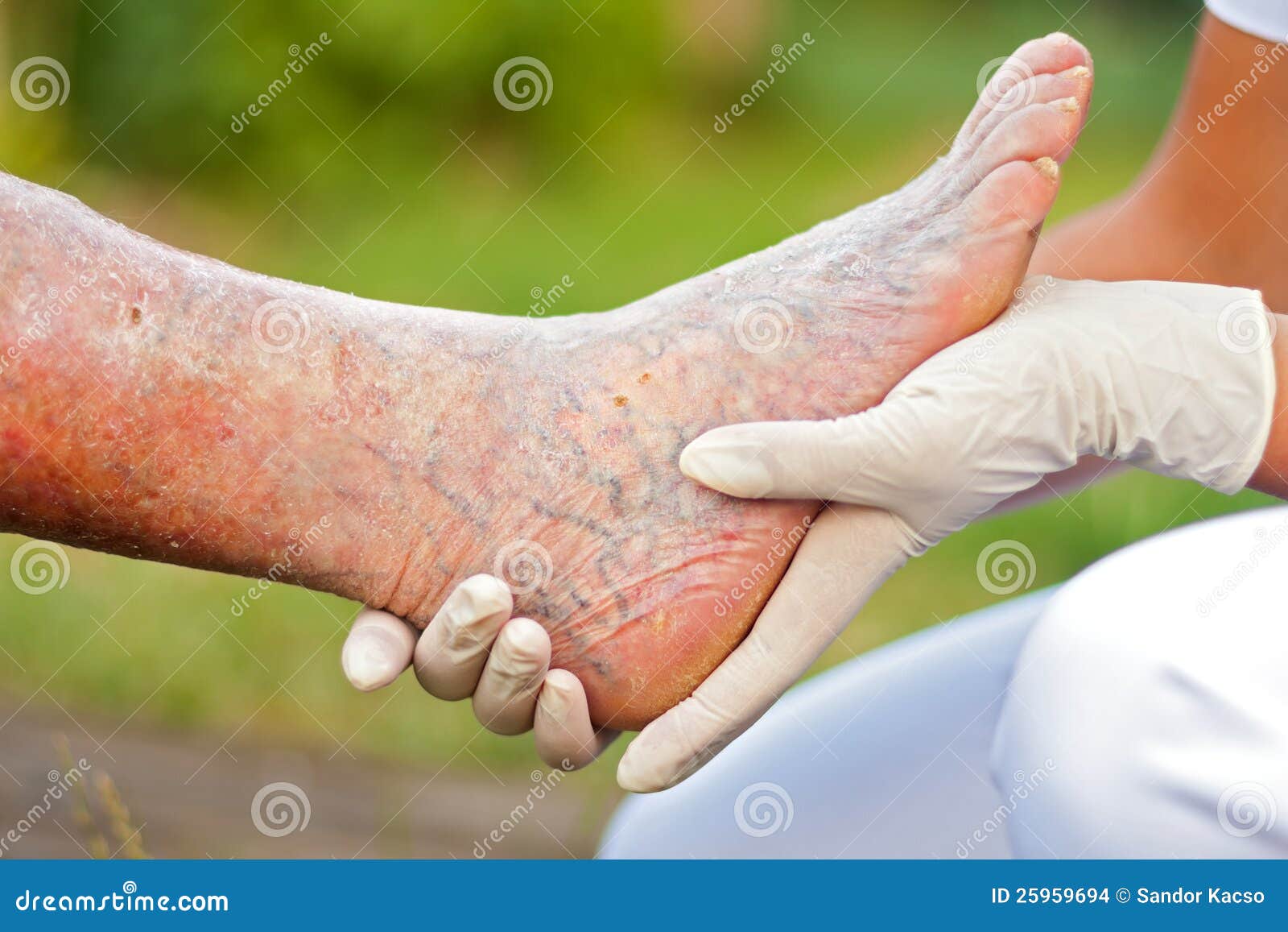 Sick elderly leg stock photo. Image of lifestyle, patient - 25959694