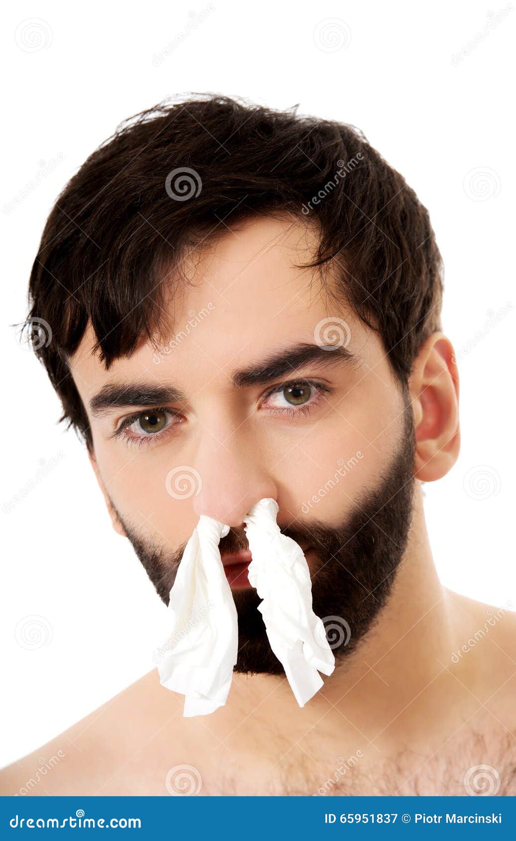Sick Man with Tissues in Nose. Stock Image Image of blowing, male