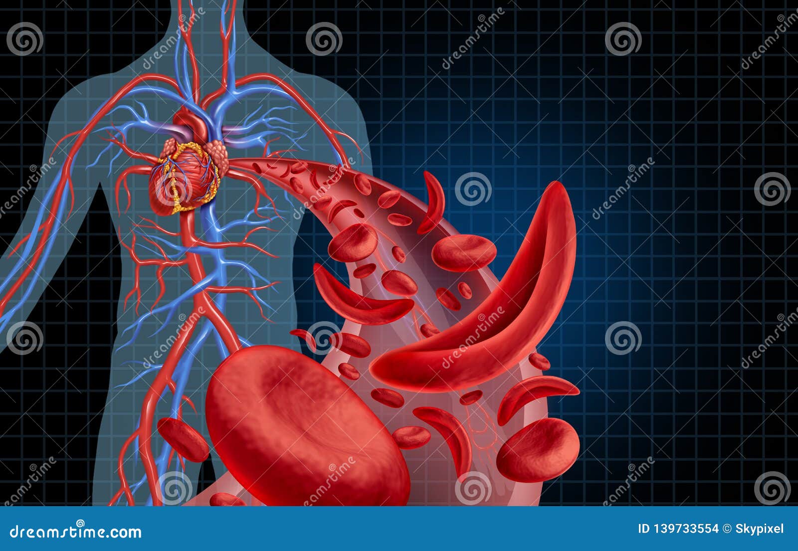 sickle cell cardiovascular