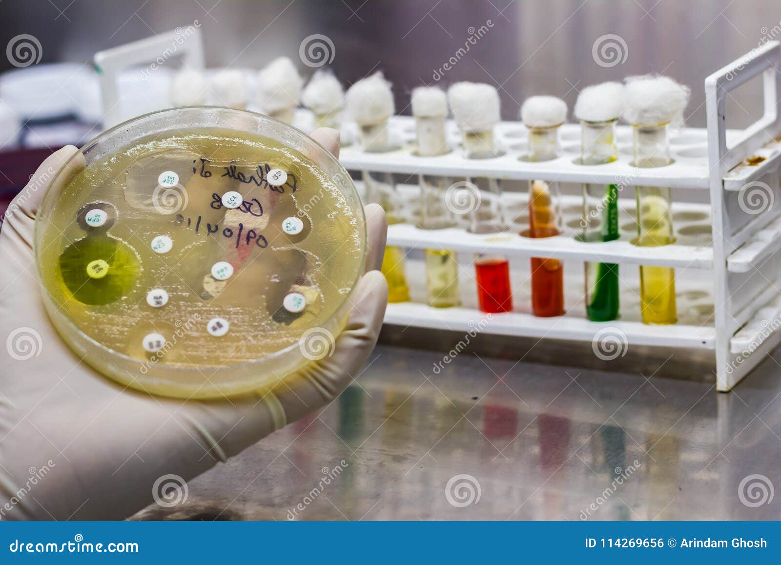 side view of culture plate of bacterial growth showing antibiotic sensitivity in their colony pattern placed geld in gloved hand