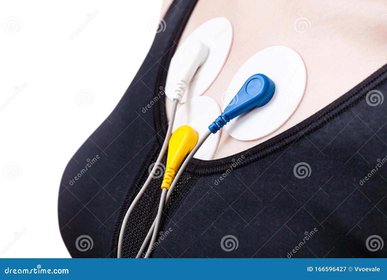 side view of electrodes of holter monitor on chest