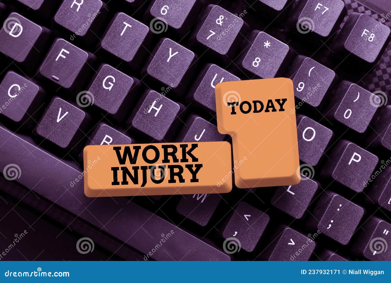 sign displaying work injury. conceptual photo an accident occurred as a result of labor resulting to an damage