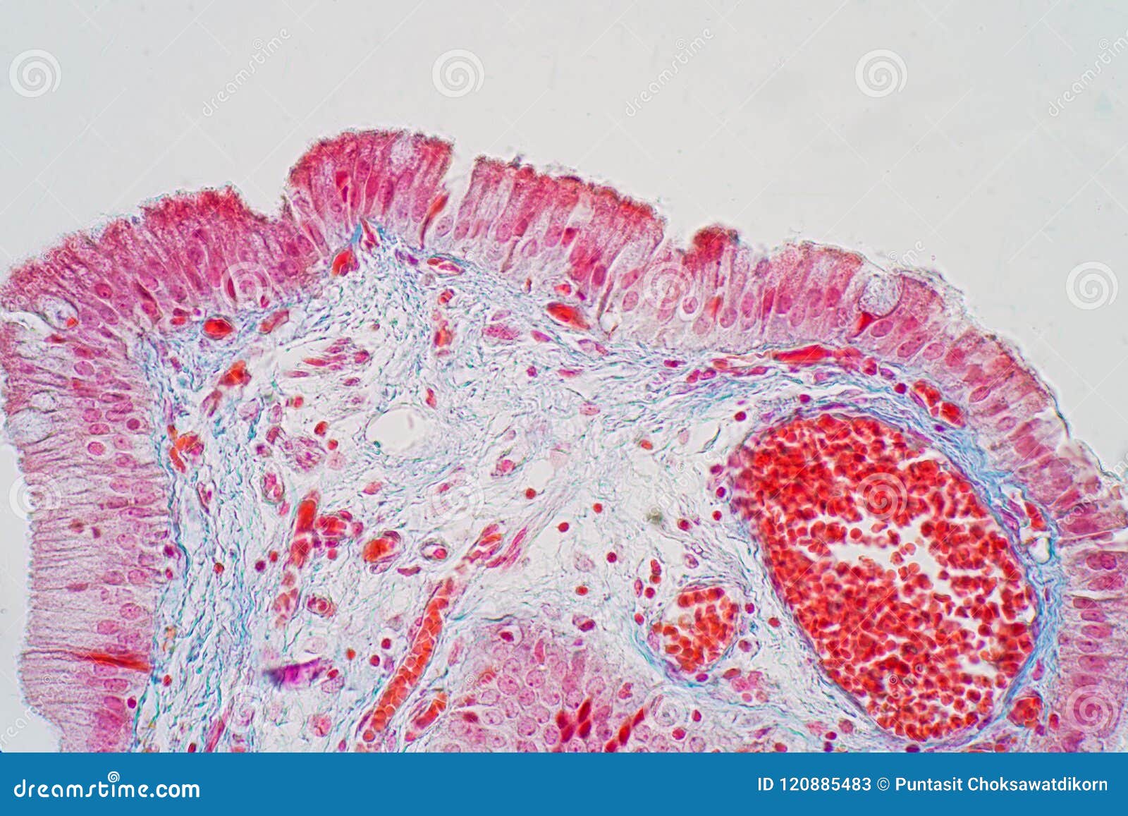 Simple Columnar Epithelium Stomach