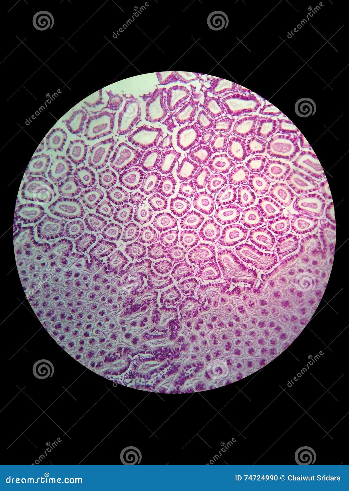 simple epithelial cell of kidney