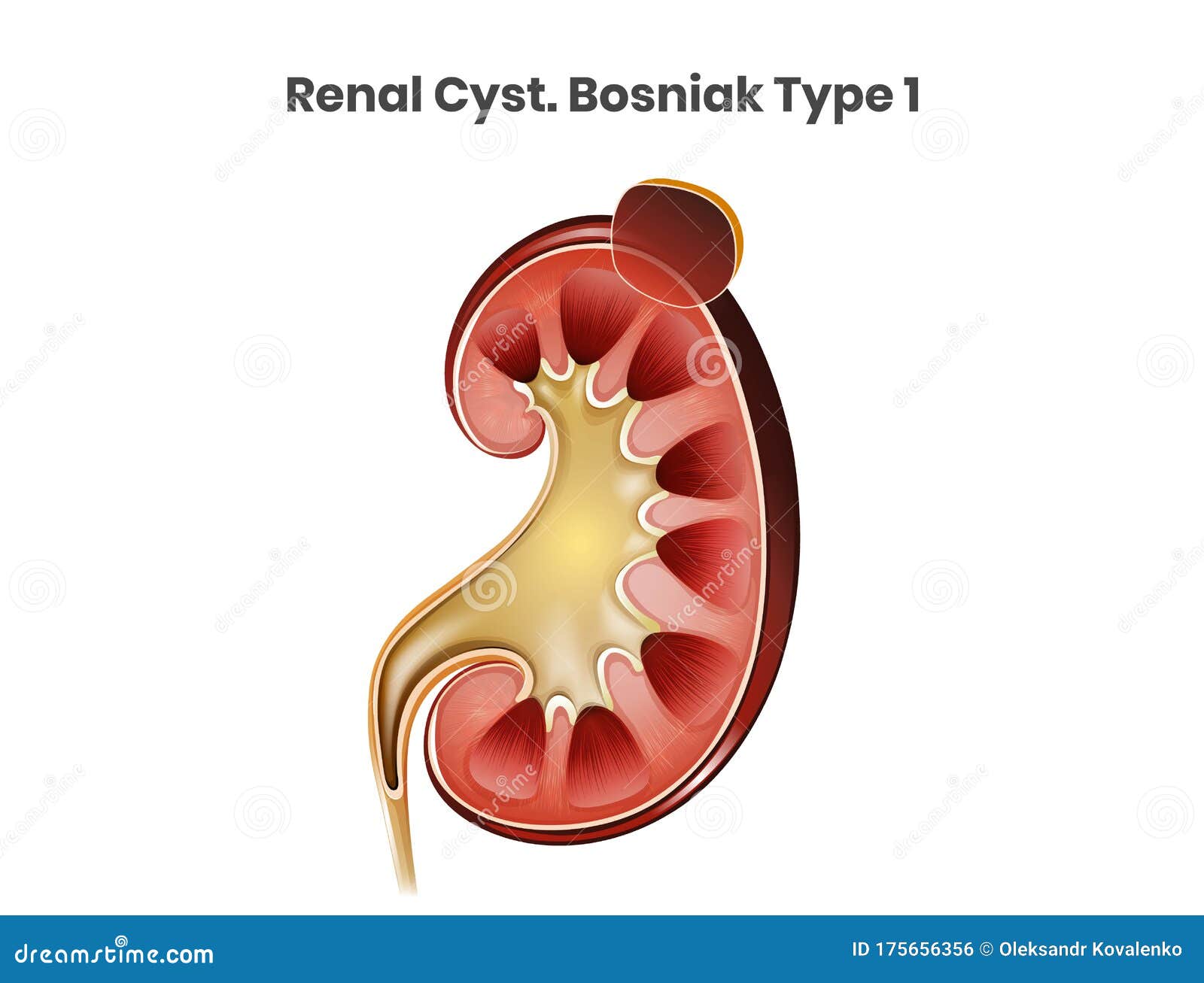 Kidney Cyst Line Icon, Human Diseases Concept, Tumor With Cysts Sign On