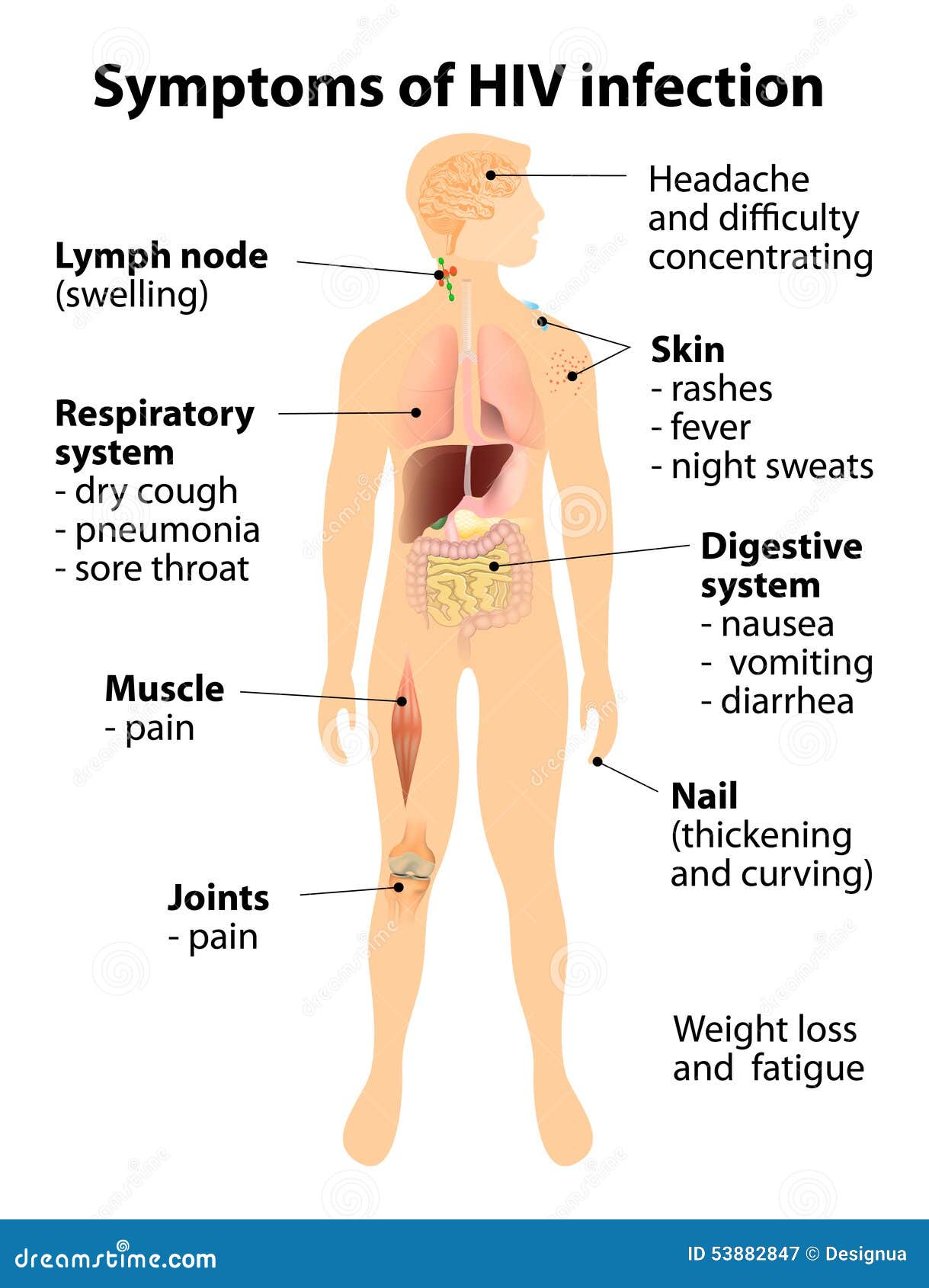 Resumo de Molusco Contagioso: sintomas, tratamento e mais!, image size:1219x1690