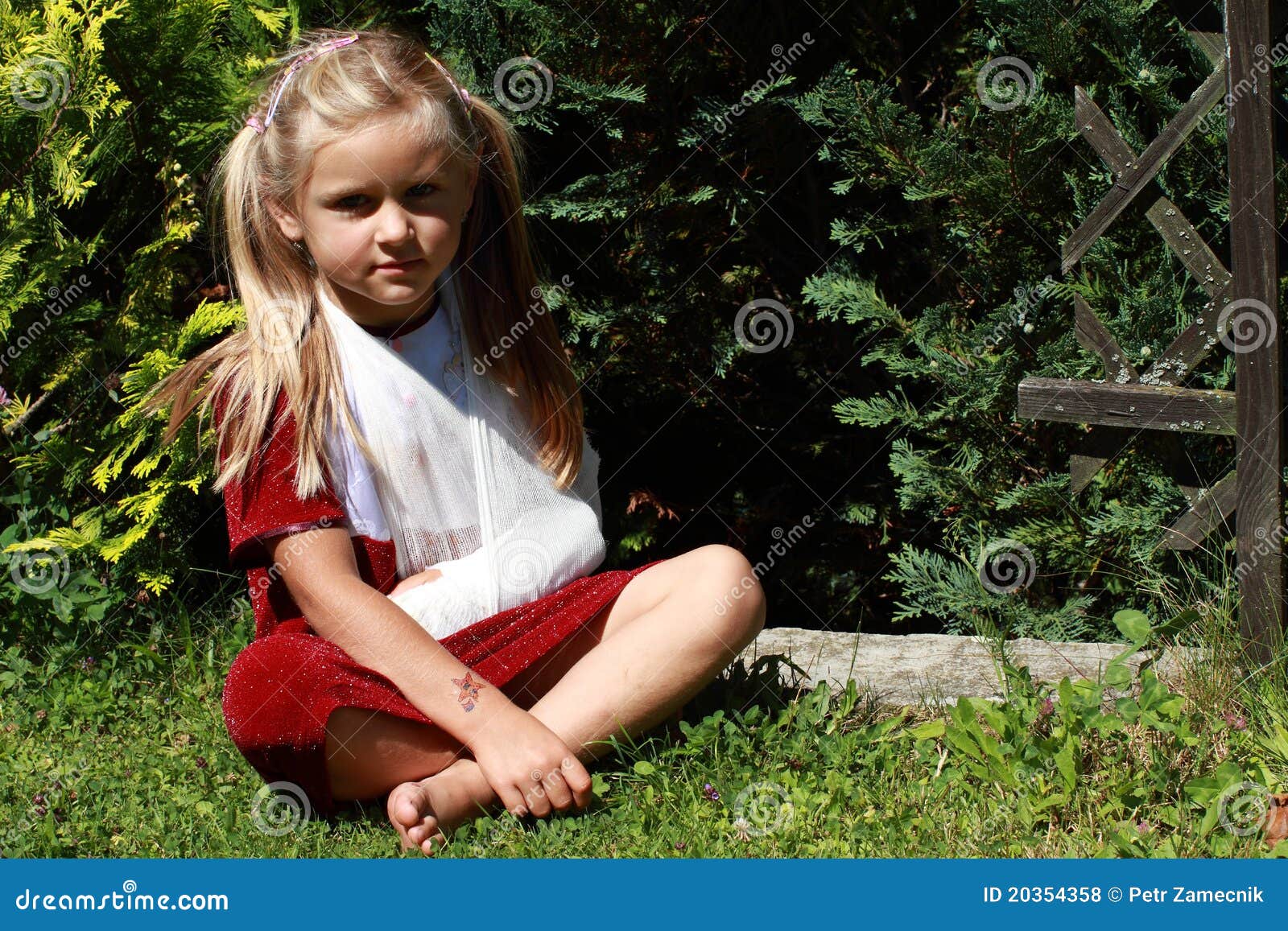 Sitting Girl with Broken Hand Stock Photo - Image of bare, barefoot ...