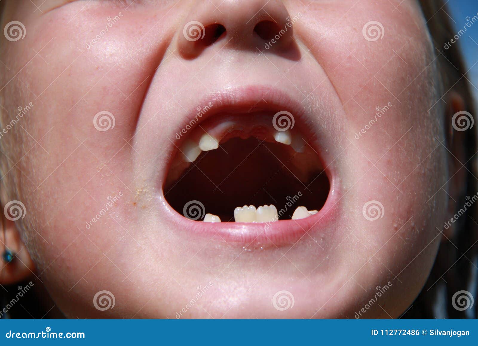 A child losing milk teeth stock photo. Image of teeth - 112772486