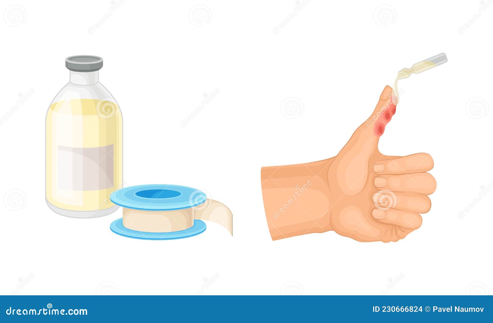 Skin Burn Injury Treatment. First Aid for Thermal Wound Stock Vector ...