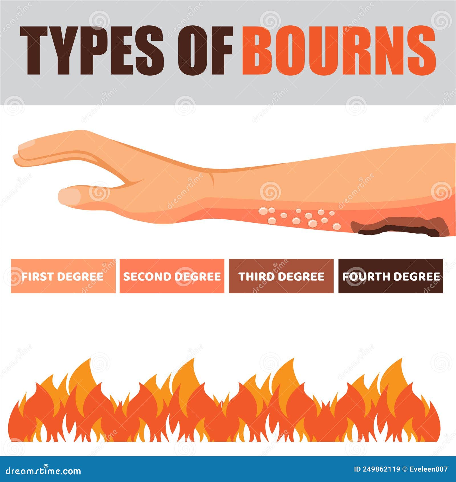 burn injury clipart