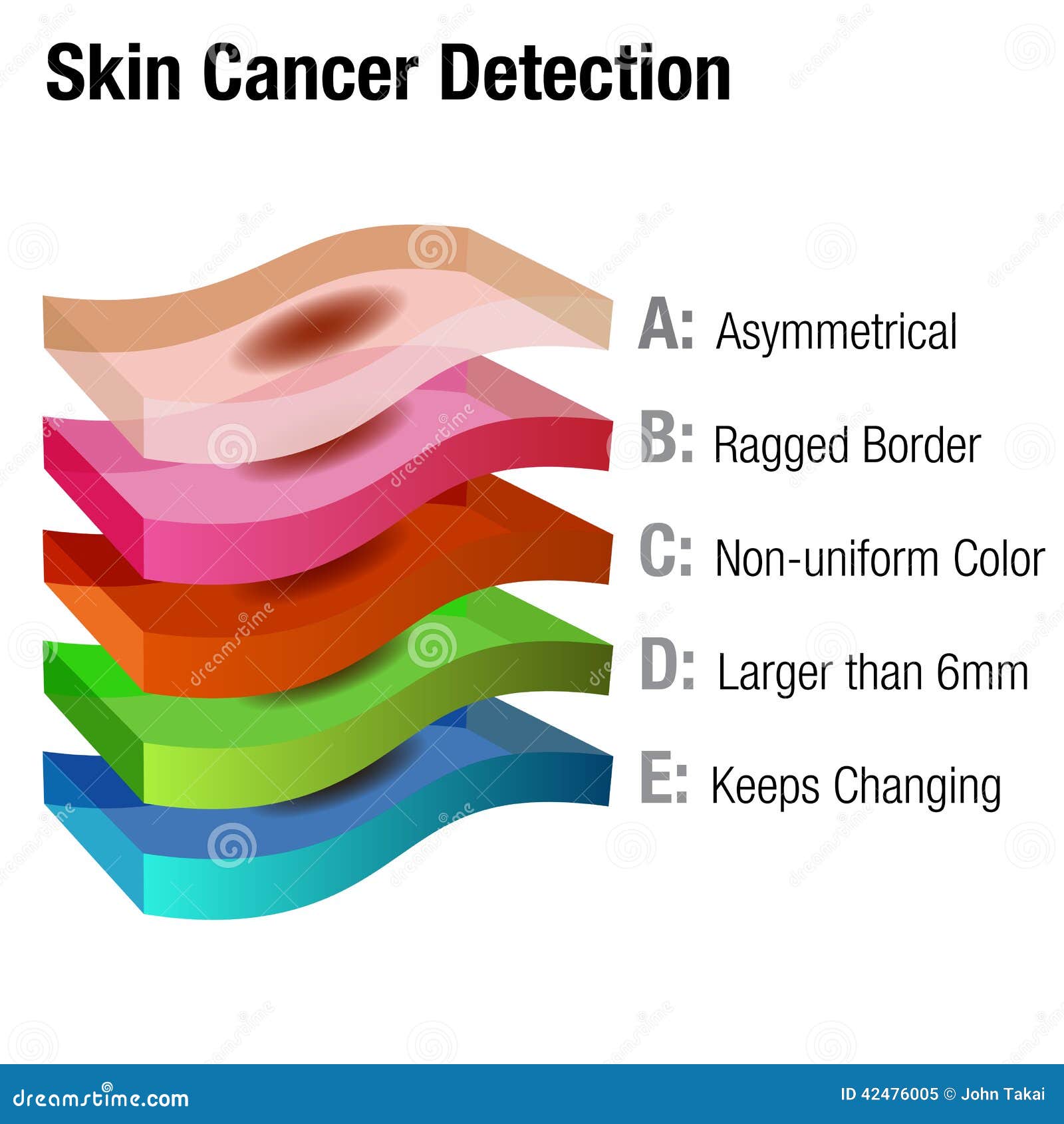 Skin Cancer Chart Pictures