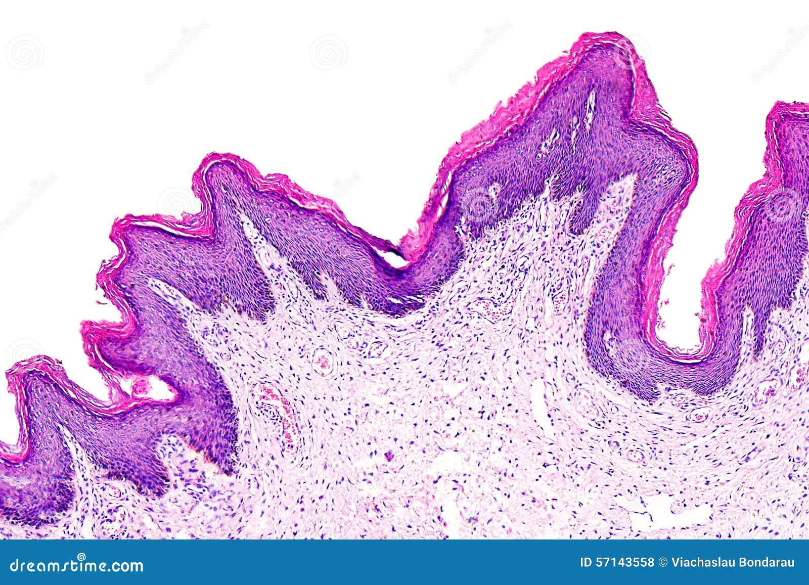 microscop papilom