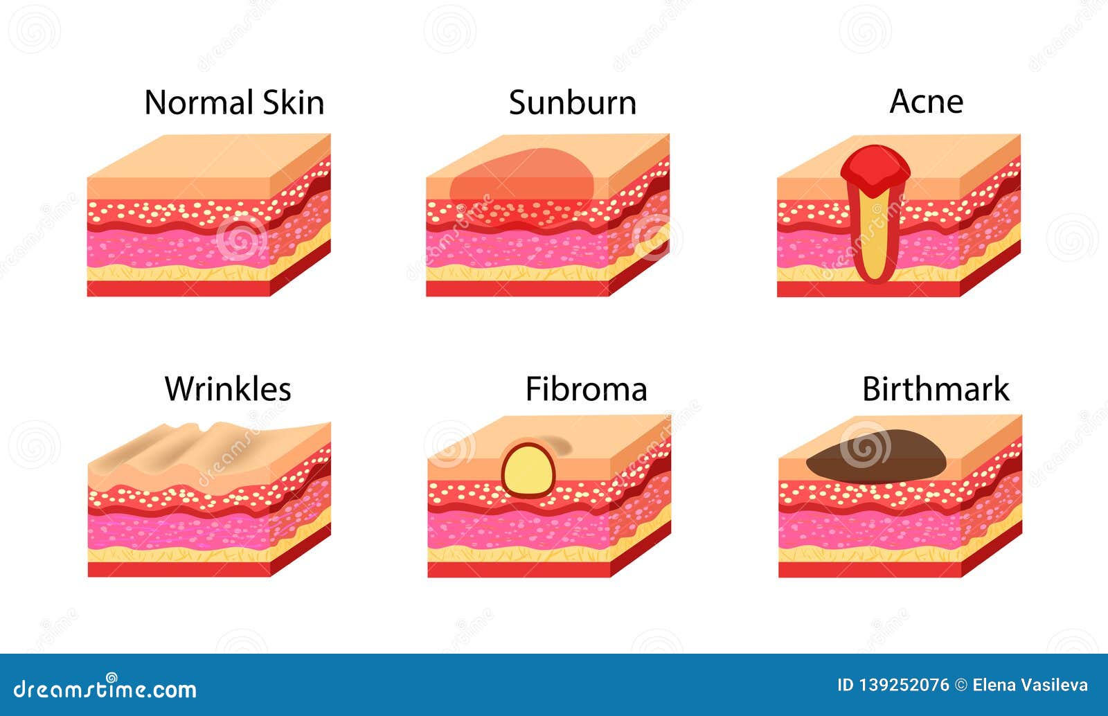 Skin Problems Icons Set. Vector Stock Illustration. Stock Vector ...